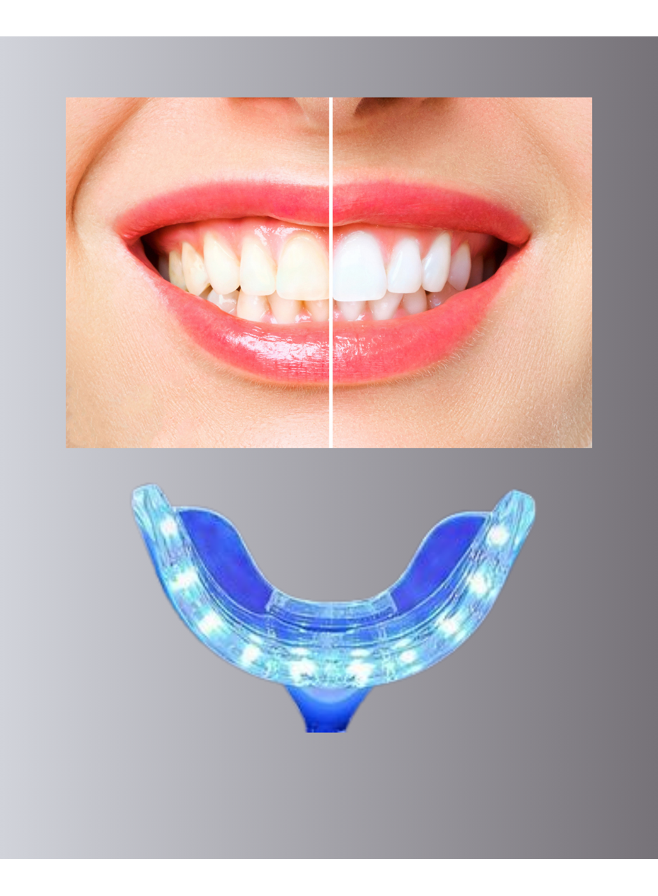LED Işıklı Profesyonel Diş Beyazlatma Seti