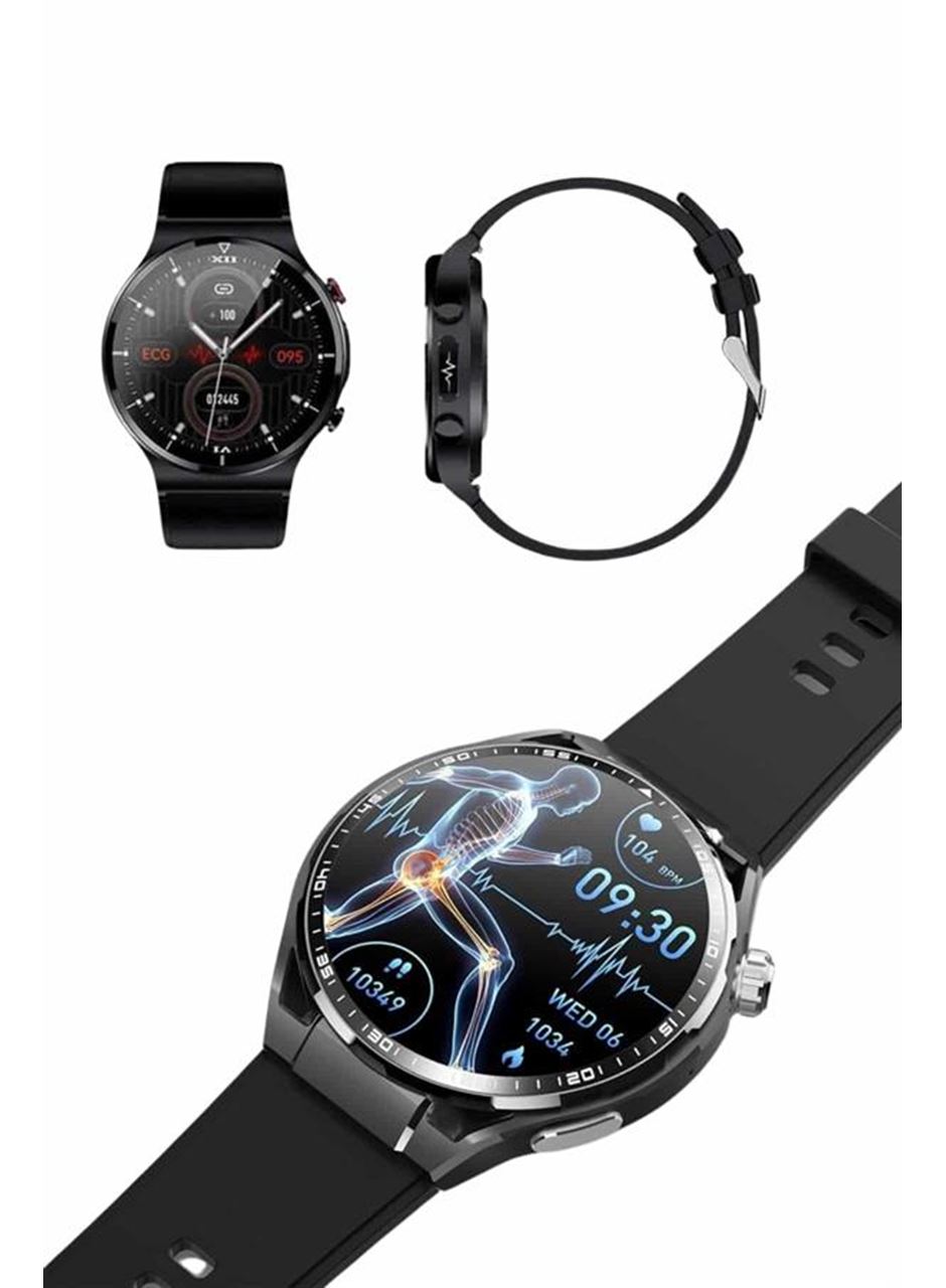 Amoled Ekran Akıllı Saat Üç Kordonlu İOS Android Uyumlu